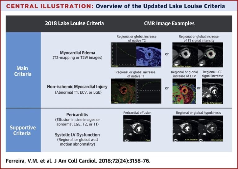 Cómo saber cuántos puntos CMR tengo acumulados en mi cuenta 2 tarjeta cmr y manos contando puntos visibles